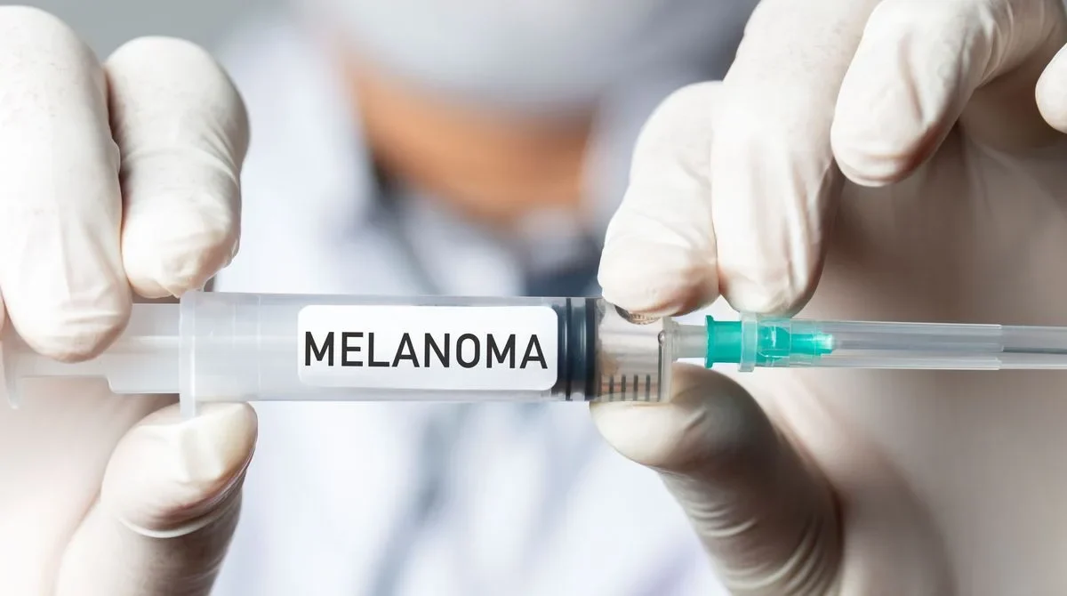 Vacina de mRNA corta 42% risco de retorno do melanoma em 24 meses