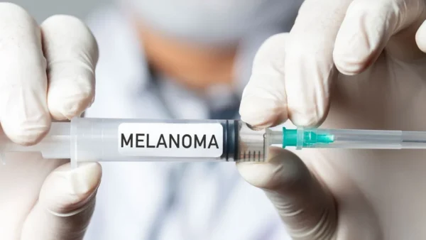 Vacina de mRNA corta 42% risco de retorno do melanoma em 24 meses
